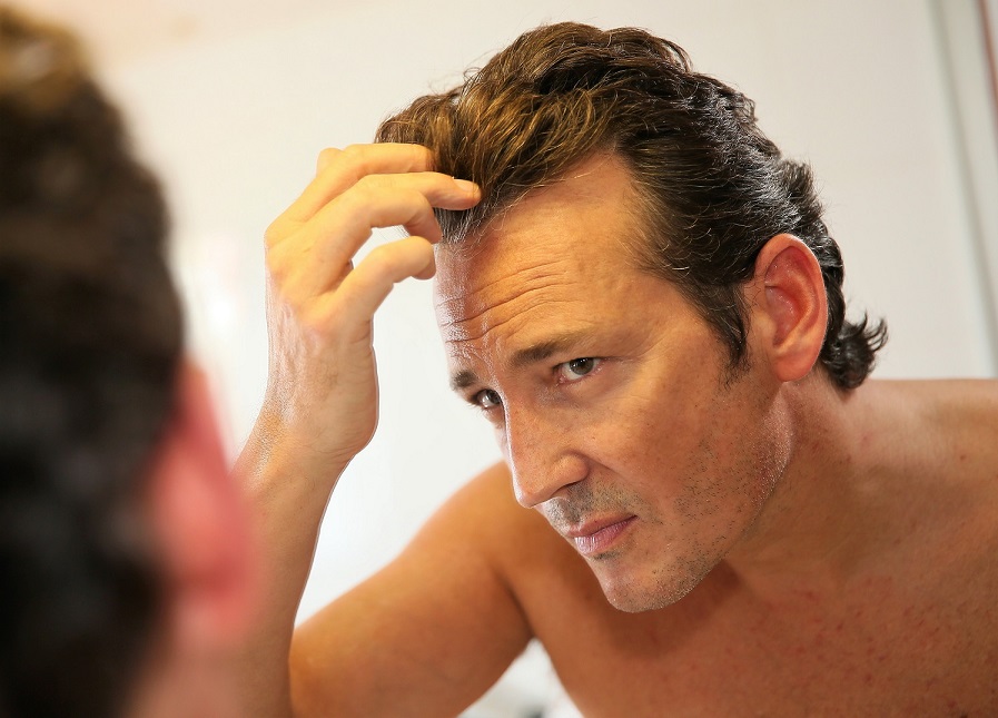 Men's Guide To Thinning Hair