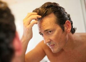 Middle-aged man concerned with hair loss
